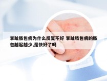 掌趾脓包病为什么反复不好 掌趾脓包病的脓包越起越少,是快好了吗