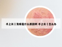 手上长廯发痒是什么原因啊 手上长廯怎么办