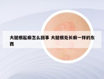 大腿根起癣怎么回事 大腿根处长癣一样的东西