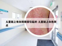 儿童腿上有白斑原因引起的 儿童腿上白色斑点