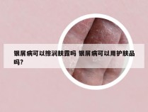 银屑病可以擦润肤露吗 银屑病可以用护肤品吗?