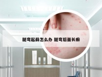 腿弯起藓怎么办 腿弯后面长癣