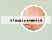 银宵癣治疗方法 银肖癣用什么药