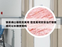 银屑病口服他克莫司 他克莫司软膏治疗银屑病可以长期使用吗