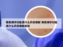 银屑病孕妇能用什么药膏缓解 银屑病孕妇能用什么药膏缓解症状