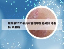 银屑病2023新药可善挺哪里能买到 可善挺 银屑病