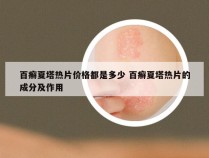 百癣夏塔热片价格都是多少 百癣夏塔热片的成分及作用