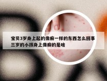 宝贝3岁身上起的像癣一样的东西怎么回事 三岁的小孩身上像癣的是啥