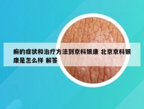 癣的症状和治疗方法到京科银康 北京京科银康是怎么样 解答