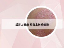 后背上长癣 后背上长癣刺挠