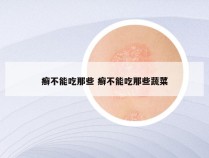 癣不能吃那些 癣不能吃那些蔬菜