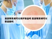 面部银屑病可以用护肤品吗 脸部银屑病可以敷面膜吗