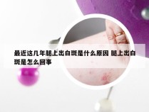 最近这几年腿上出白斑是什么原因 腿上出白斑是怎么回事