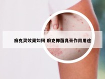 癣克灵效果如何 癣克抑菌乳膏作用用途