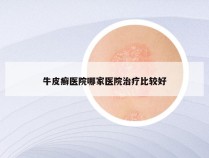 牛皮癣医院哪家医院治疗比较好