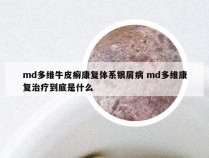 md多维牛皮癣康复体系银屑病 md多维康复治疗到底是什么