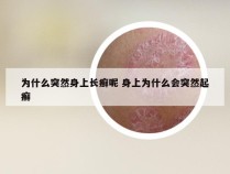 为什么突然身上长癣呢 身上为什么会突然起癣