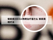 银屑病308311物理治疗是什么 银屑病理疗法