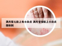 满月婴儿脸上有小白点 满月宝宝脸上小白点像粉刺