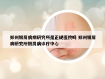 郑州银屑病病研究所是正规医院吗 郑州银屑病研究所银屑病诊疗中心