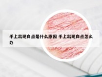 手上出现白点是什么原因 手上出现白点怎么办