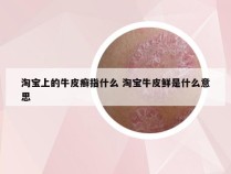 淘宝上的牛皮癣指什么 淘宝牛皮鲜是什么意思