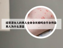 经常漂女人的男人全身会长癣吗会不会传染 男人为什么漂昌