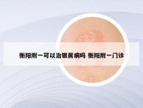 衡阳附一可以治银屑病吗 衡阳附一门诊