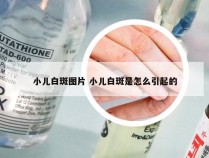 小儿白斑图片 小儿白斑是怎么引起的