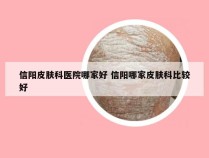 信阳皮肤科医院哪家好 信阳哪家皮肤科比较好