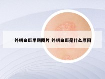 外明白斑早期图片 外明白斑是什么原因