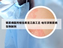 银屑病医院相信黑龙江森工总 哈尔滨银屑病生物制剂