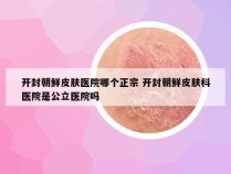 开封朝鲜皮肤医院哪个正宗 开封朝鲜皮肤科医院是公立医院吗