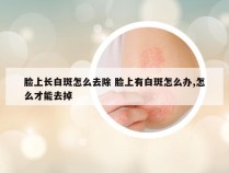 脸上长白斑怎么去除 脸上有白斑怎么办,怎么才能去掉