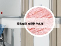 现状皮藓 皮藓长什么样?