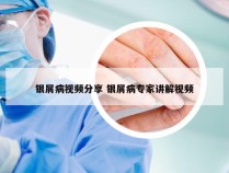 银屑病视频分享 银屑病专家讲解视频