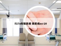 il17a和银屑病 银屑病acr20