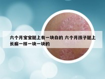 六个月宝宝腿上有一块白的 六个月孩子腿上长癣一样一块一块的