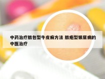 中药治疗脓包型牛皮癣方法 脓疱型银屑病的中医治疗