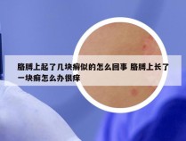 胳膊上起了几块癣似的怎么回事 胳膊上长了一块癣怎么办很痒