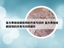 复方黄柏祛癣搽剂的作用与功效 复方黄柏祛癣搽剂的作用与功效图片