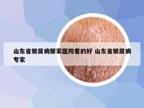 山东省银屑病那家医院看的好 山东省银屑病专家