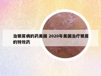 治银屑病的药美国 2020年美国治疗银屑的特效药