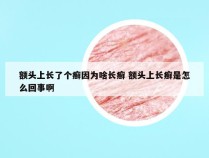 额头上长了个癣因为啥长癣 额头上长癣是怎么回事啊