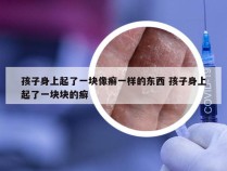 孩子身上起了一块像癣一样的东西 孩子身上起了一块块的癣