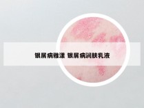 银屑病雅漾 银屑病润肤乳液