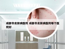 成都市皮肤病医院 成都市皮肤病医院哪个医院好