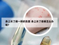 身上长了癣一样的东西 身上长了些癣怎么办呢?