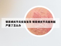 银屑病关节炎反复复发 银屑病关节炎越来越严重了怎么办