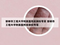 邯郸市工程大学附属医院皮肤科专家 邯郸市工程大学附属医院皮肤科专家